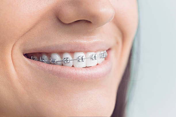 Best Traditional Braces  in Crane, TX